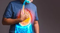 Tidur Setelah Makan: Risiko GERD Meningkat, Kata Dokter